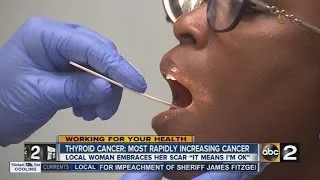 Thyroid Cancer on the rise
