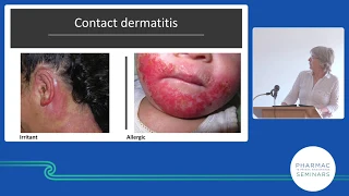 PHARMAC seminar: Dermatology update,  emollients part 1