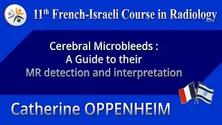 Cerebral Microbleeds: A Guide to their MR detection and interpretation - Catherine OPPENHEIM