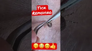 Wood tick removal