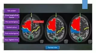 MRI Brain Sectional Anatomy Section 1,2 & 3