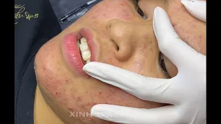 Satisfying videos for Relaxation with XINH SPA CHANNEL 5 #230