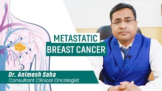 Metastatic breast cancer | Stage IV breast cancer | Best Oncologist in Kolkata