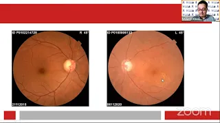 AIOC2021-IC347-Topic-Dr.Amit Khosla