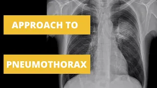 Approach to Pneumothorax - How to Read a Chest X Ray