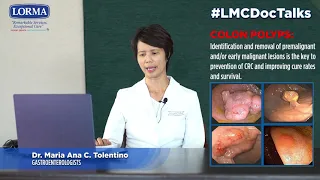 LMC DocTalks: Colorectal Cancer by. Dra. Maria Ana C. Tolentino