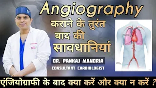 Angiography के तुरंत बाद की सावधानियां | हार्ट पेशेंट्स एंजियोग्राफी के बाद देखभाल कैसे करें ?