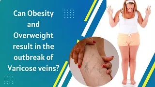 Varicose Veins  -  Symptoms and Treatment  Explained  Dr Rajah V Koppala  | Avis Hospitals