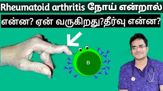 Rheumatoid arthritis explanation in tamil/medical awareness in tamil