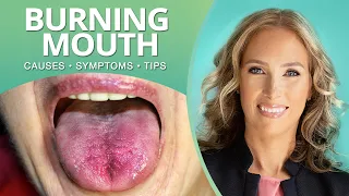 What Is Burning Mouth Syndrome, Causes, Symptoms & Tips | Dr. J9 Live