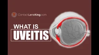 Uveitis Eye Symptoms and Causes