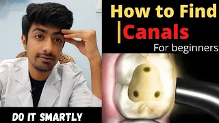 How to Find Canals while RCT || Must Remembering Points || Dental ji