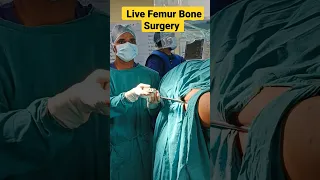 Live Femur Bone Surgery | #femur #bonefracture #bonepain #orthopedicdoctor #mbbs #medicalstudents |