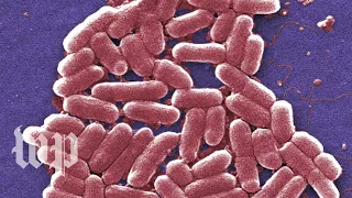 E. coli infections are gross. Here are 5 facts you can't unlearn about them.