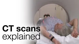 How to prepare for a CT scan