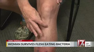 Sanford woman recovering from rare flesh-eating bacteria infection