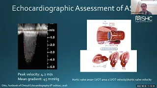 Dr. Andrew Harris Presents "Echocardiographic Assessment of Aortic Stenosis and Post-TAVR"