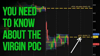 THIS Will Improve your Day Trading Forever (vPOC)