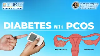 Diabetes With PCOD | Risk in PCOD, Type 2 Diabetes Symptoms, Treatment and Prevention in Surat