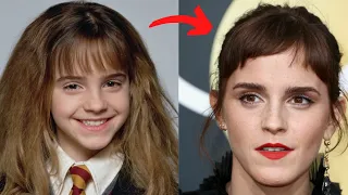 Harry Potter 2001 Cast Then And Now 2022 How They Changed!!