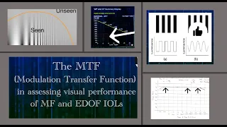 The MTF-(Modulation Transfer Function) and its role in assessing visual performance of premium IOLS