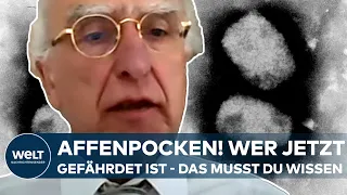 AFFENPOCKEN IN DEUTSCHLAND: Welche Menschen besonders gefährdet sind! Das musst du jetzt wissen