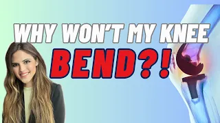 Top Reasons Why Knee Will Not Bend After A Knee Replacement (Yes, You Can Fix It!!)