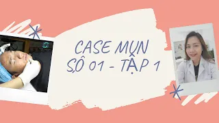 CASE ĐIỀU TRỊ MỤN 01 - TẬP 1 ( TÀI TRỢ 05 BẠN / THÁNG )