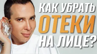 ОТЕКИ ЛИЦА