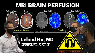 The Value of MRI Brain Perfusion when evaluating Brain Tumors Like Gliomas Explained by Dr. Hu.