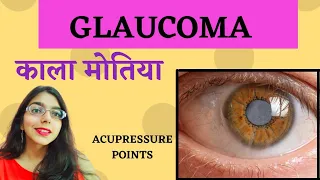 काला मोतिया /GLAUCOMA ACUPRESSURE POINTS BY PURVI MARU