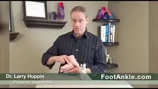 Treatment of Numb Big Toes and Big Toe Callus with Seattle Foot Doctor Larry Huppin