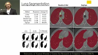 Segmentation with capsule network by Rodney Lalonde, UCF