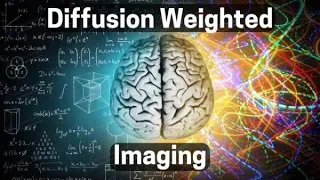 DWI MRI (MS, Hydrocephalus and Cancer) Brain Scanning Sequence