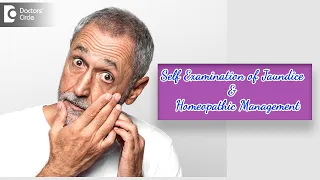 Ways To Recognize Jaundice (Self Examination) | Homeopathy Cure- Dr.Sanjay Panicker| Doctors' Circle