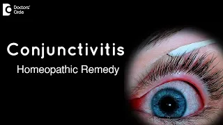 Homeopathic remedy for conjunctivitis - Dr. Surekha Tiwari