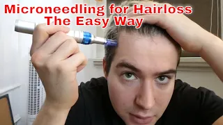 MICRONEEDLING FOR HAIRLOSS: The Easy Way