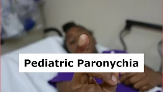 Pediatric Paronychia Drainage
