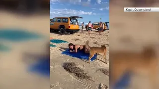 Australia  Dingo  Dog bites sunbathing tourist in Queensland Beach  Bite by DINGO