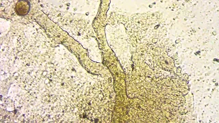 Slime mold pulsating (shuttle streaming)