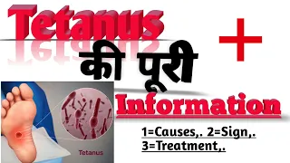 Clostridium Tetani(Tetanus)-causes,symptom, Diagnosis, treatment, pathology. ||2020.