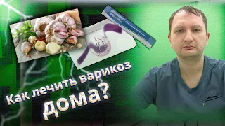 Как лечить варикоз дома