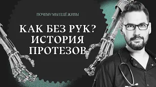 Как без рук: история протезирования конечностей / Почему мы еще живы