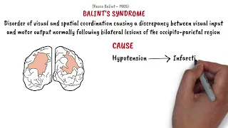 Balint's syndrome | MinsEducation |