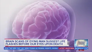 Brain scans of dying man suggest life flashes before eyes upon death | Rush Hour