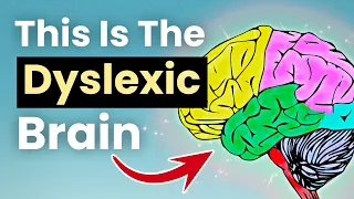 Dyslexia and ADHD - The TRUTH About Being The "Stupidest" Person In The Room | Kate Griggs