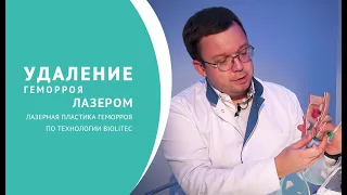 Удаление геморроя лазером – метод лазерной пластики