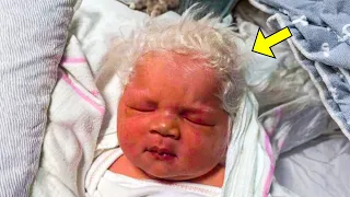 This Baby Was Born With White Hair. The Reason Left Doctors in Shock!