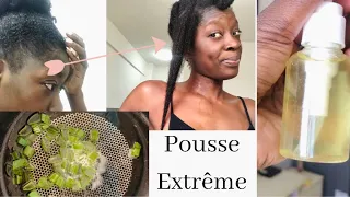 HUILE DE POUSSE Aloe Vera | hydrate, tonifie, stop la chute, stimule la pousse des tempes dégarnies