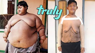 'World’s Heaviest Kid' Has Saggy Skin Surgery | TRULY